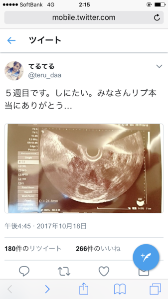 風俗嬢さんがとんでもない妊娠の仕方をする：コメント1