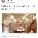 風俗嬢さんがとんでもない妊娠の仕方をする