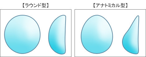 シリコンで胸盛ってる人に質問：コメント78