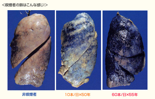 タバコとガンの関係性が無いのではと発覚：コメント76