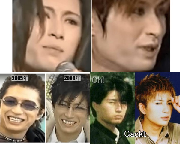 GACKT、若さの秘訣は「1日1食、ジュース飲まない、糖分取らない」…：コメント9